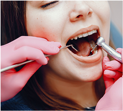 Root Canals Services